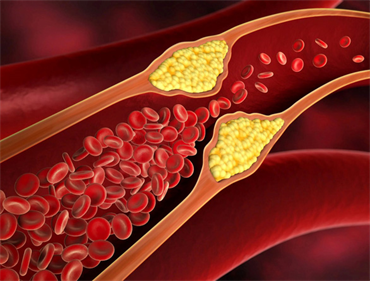 Các phát hiện mới liên quan lượng cholesterol trong máu